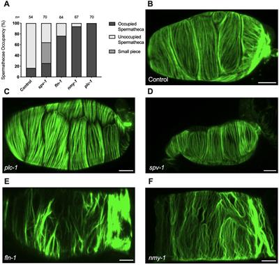 Tensions on the actin cytoskeleton and apical cell junctions in the C. elegans spermatheca are influenced by spermathecal anatomy, ovulation state and activation of myosin